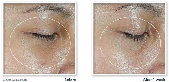 RoC Multi Correxion eye stick - Revive + Glow - 4 gram