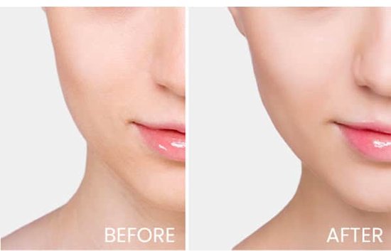 Nuxe Prodigieux Boost gezichtsserum - 30 ml