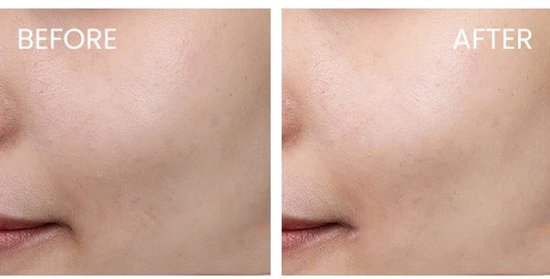 Caudalie Beauty Elixir gezichtsspray - stralende huid - 30 ml