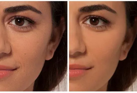 L'Oréal Paris True Match concealer - neutrale ondertoon - 4N Beige - 6,8 ml