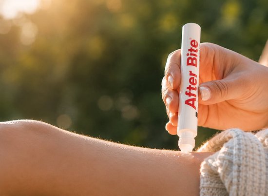 After Bite Xtra doseerpen - bij insectenbeten en jeuk - 20 ml