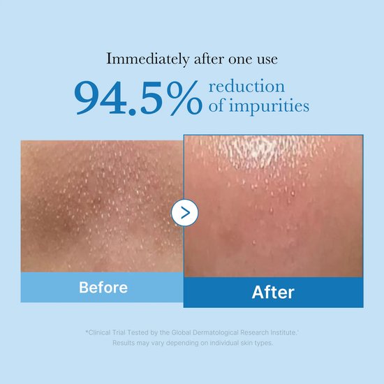 Medicube Zero Pore reinigingsolie - blackhead deep cleansing - 205 ml