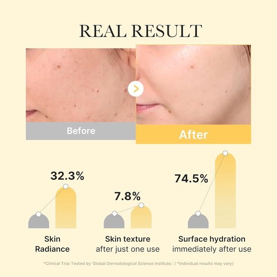 Medicube gelmasker - Kojic Acid & Turmeric - brightening